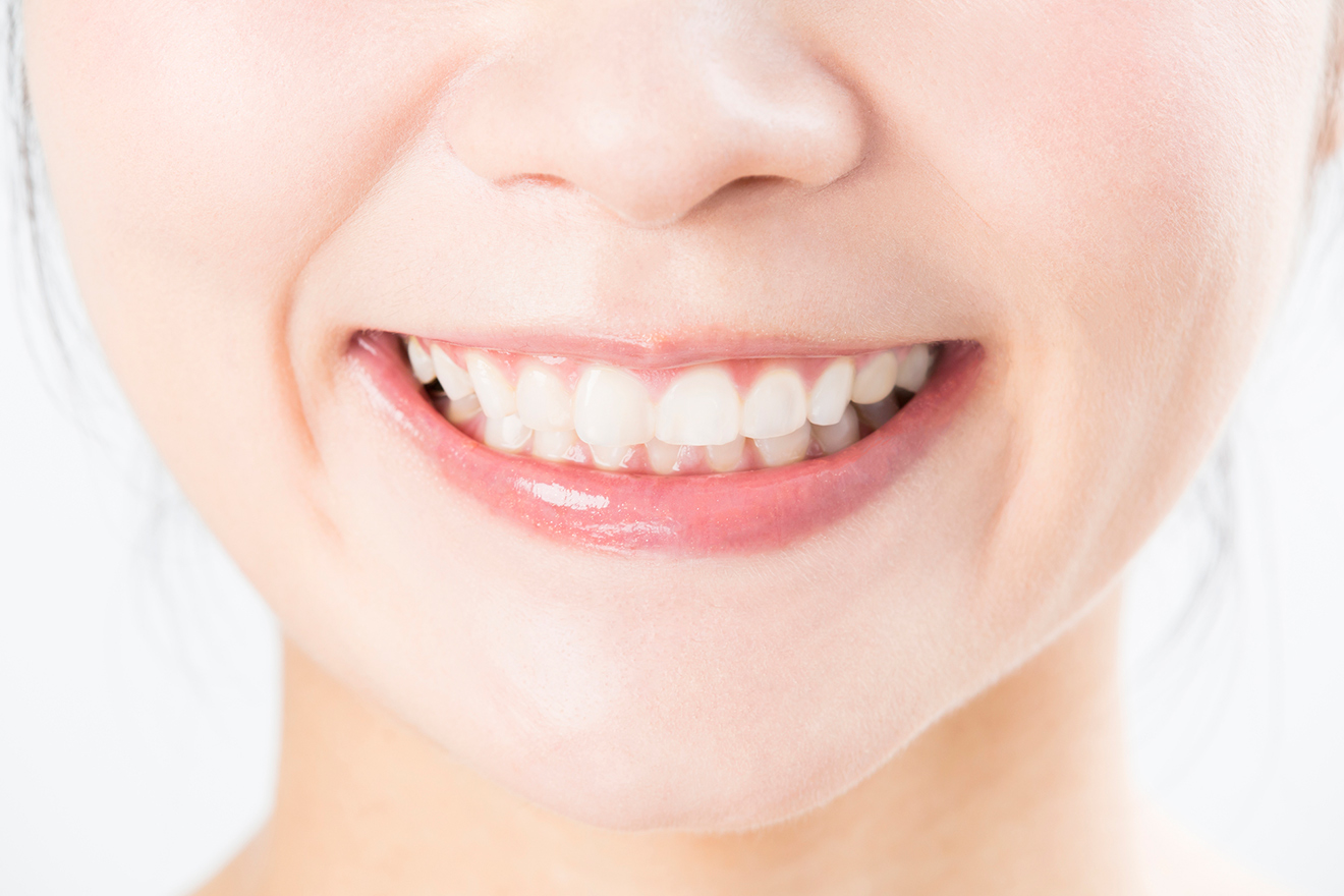 天然歯に近い白い歯に治療する