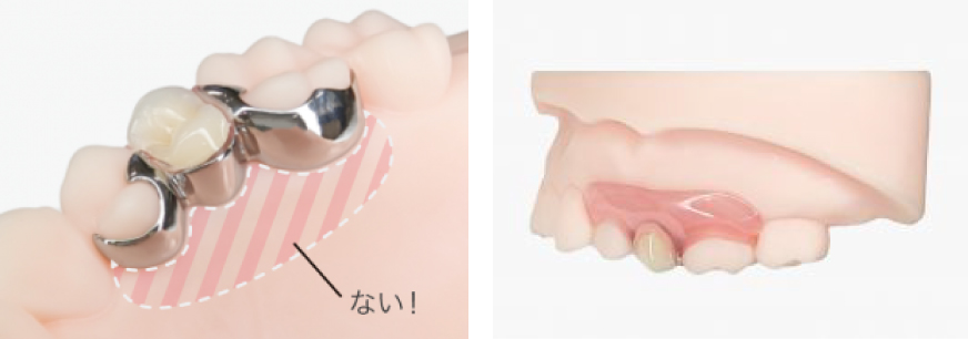 コンティースの特徴